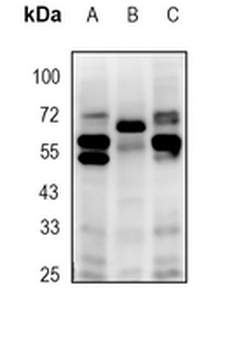 FTO Rabbit Monoclonal Antibody
