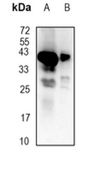 STING Rabbit Monoclonal Antibody
