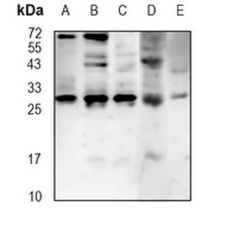 CBX7 Rabbit Monoclonal Antibody
