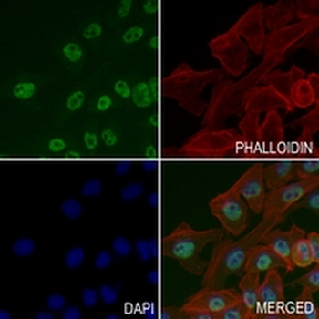 CBX7 Rabbit Monoclonal Antibody