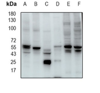 ATG12 Rabbit Monoclonal Antibody