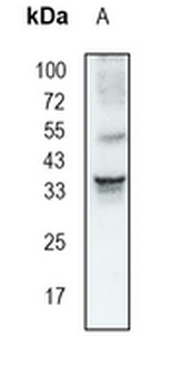 BOB1 Rabbit Monoclonal Antibody