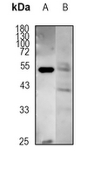 Factor IX Rabbit Monoclonal Antibody