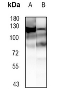NF-kappaB p100 Rabbit Monoclonal Antibody