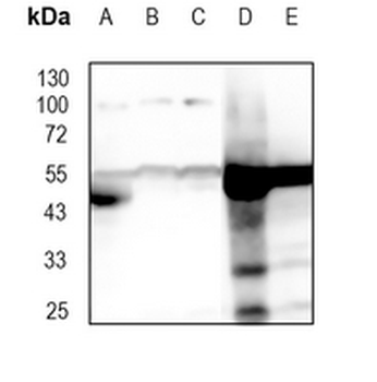 Cytochrome P450 2D6 Rabbit Monoclonal Antibody