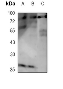 PKC eta Rabbit Monoclonal Antibody