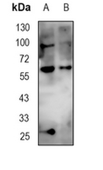 Clusterin Rabbit Monoclonal Antibody