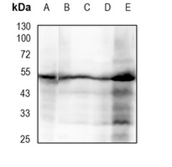 Fascin Rabbit Monoclonal Antibody