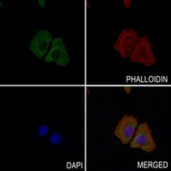 Fascin Rabbit Monoclonal Antibody