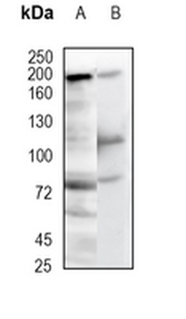Complement C4-A Rabbit Monoclonal Antibody