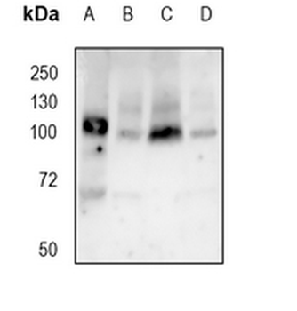 Apolipoprotein E Receptor 2 Rabbit Monoclonal Antibody