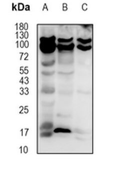 Cholinesterase Rabbit Monoclonal Antibody