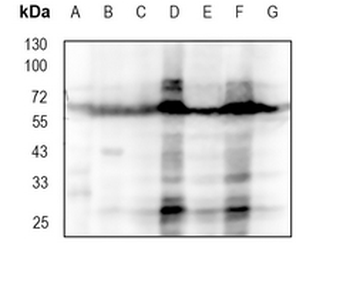 CRMP2 Rabbit Monoclonal Antibody