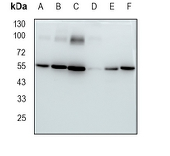 Glutathione Reductase Rabbit Monoclonal Antibody