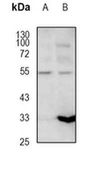 Antithrombin III Rabbit Monoclonal Antibody
