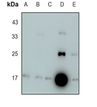 LMO2 Rabbit Monoclonal Antibody