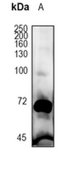 PCSK9 Rabbit Monoclonal Antibody