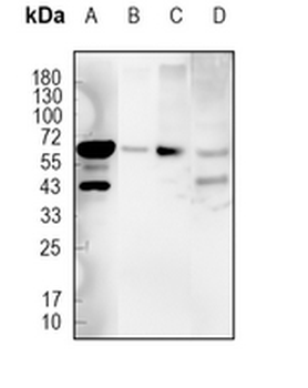 EAAT2 Rabbit Monoclonal Antibody