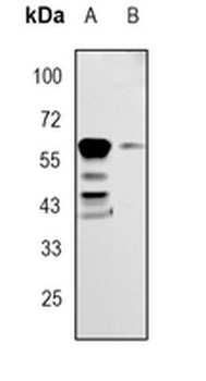 RPE65 Rabbit Monoclonal Antibody
