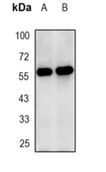GRP58 Rabbit Monoclonal Antibody
