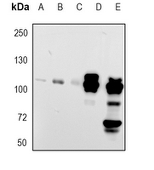 MUC2 Rabbit Monoclonal Antibody
