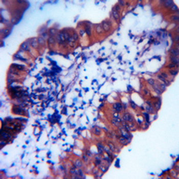 MUC2 Rabbit Monoclonal Antibody