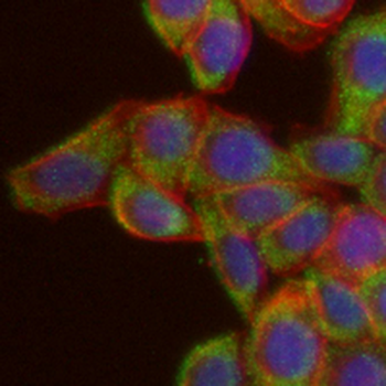 MUC2 Rabbit Monoclonal Antibody