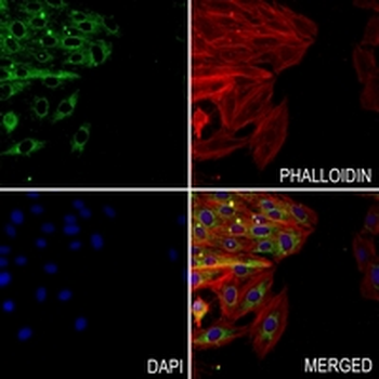 FABP1 Rabbit Monoclonal Antibody