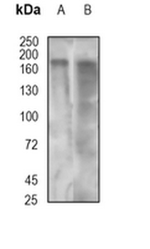 CD66e Rabbit Monoclonal Antibody