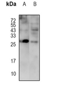 GADD153 Rabbit Monoclonal Antibody
