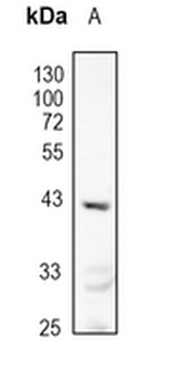 AT1 Rabbit Monoclonal Antibody