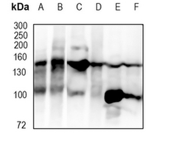 53BP2 Rabbit Monoclonal Antibody