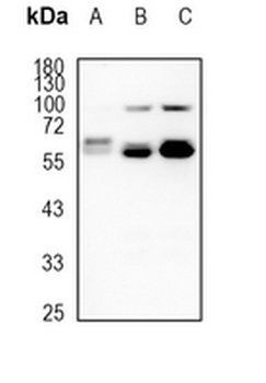 FTCD Rabbit Monoclonal Antibody