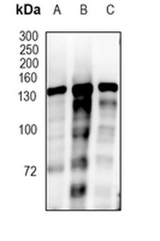 BCL11B Rabbit Monoclonal Antibody