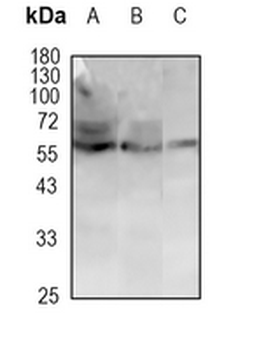 PDIA2 Rabbit Monoclonal Antibody