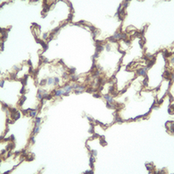 AGER Rabbit Monoclonal Antibody