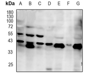 Laminin Receptor Rabbit Monoclonal Antibody