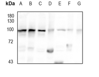 Glucocorticoid Receptor Rabbit Monoclonal Antibody