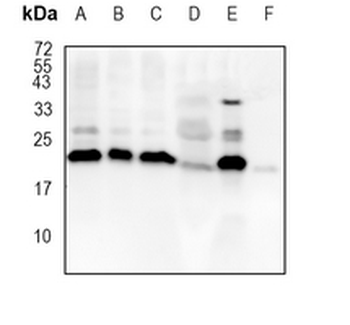 Peroxiredoxin 1 Rabbit Monoclonal Antibody