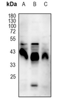 CD95 Rabbit Monoclonal Antibody