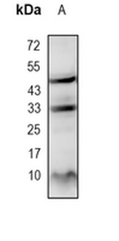 IGF2 Rabbit Monoclonal Antibody