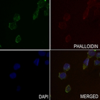 IGF2 Rabbit Monoclonal Antibody