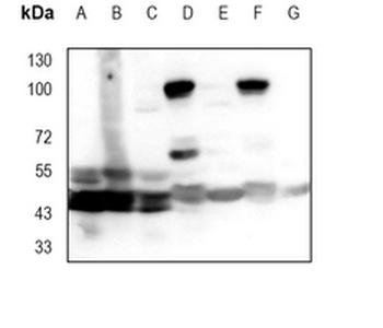 JNK1/3 Rabbit Monoclonal Antibody