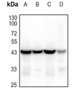 MKK2 Rabbit Monoclonal Antibody