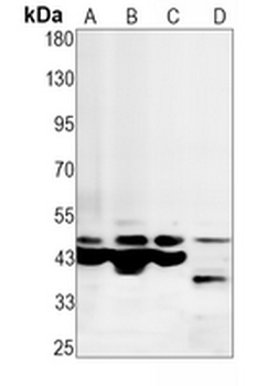 Caspase 9 Rabbit Monoclonal Antibody