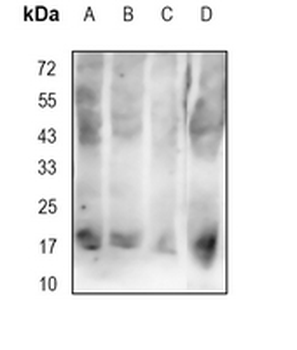 AGR2 Rabbit Monoclonal Antibody
