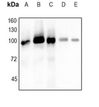 Topoisomerase 1 Rabbit Monoclonal Antibody