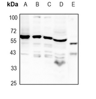 Angiopoietin-1 Rabbit Monoclonal Antibody