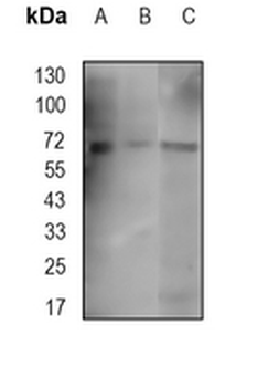 IRAK3 Rabbit Monoclonal Antibody