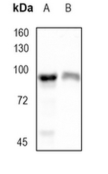 IKK beta Rabbit Monoclonal Antibody